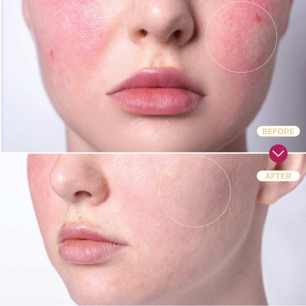 BASE LABORATORIES limpieza diaria de la piel con hipocloroso suave y natural.