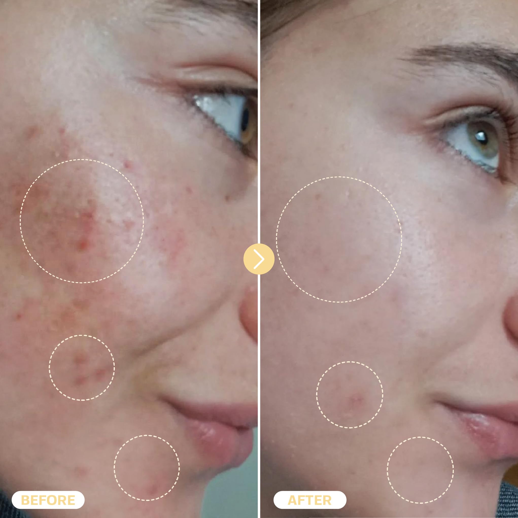 BASE LABORATORIES ayuda a la piel con irritaciones, enrojecimiento e imperfecciones.