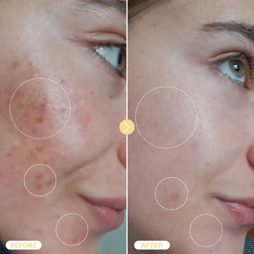 BASE LABORATORIES ayuda a la piel con irritaciones, enrojecimiento e imperfecciones.