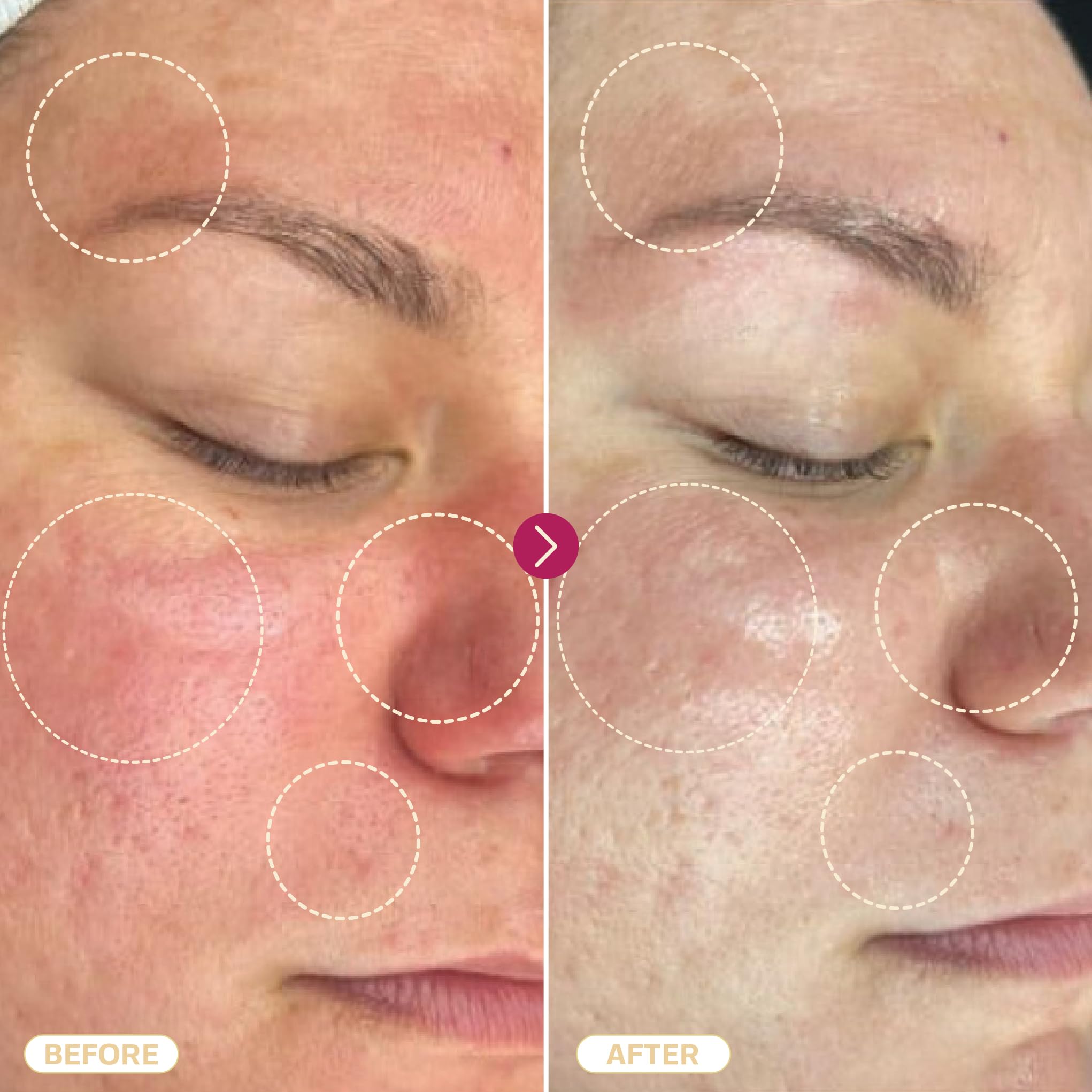 BASE LABORATORIES uso diario de tonificante facial suave y calmante