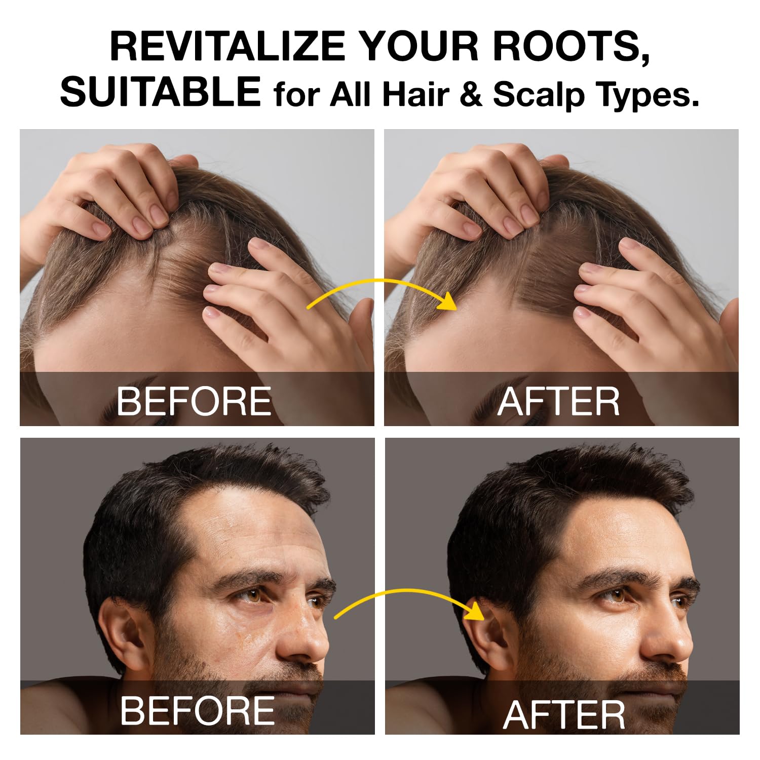 Beadlamey shampoing activateur de racines — application sur le cuir chevelu pour soin ciblé