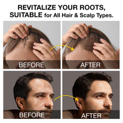 Beadlamey shampoing activateur de racines — application sur le cuir chevelu pour soin ciblé