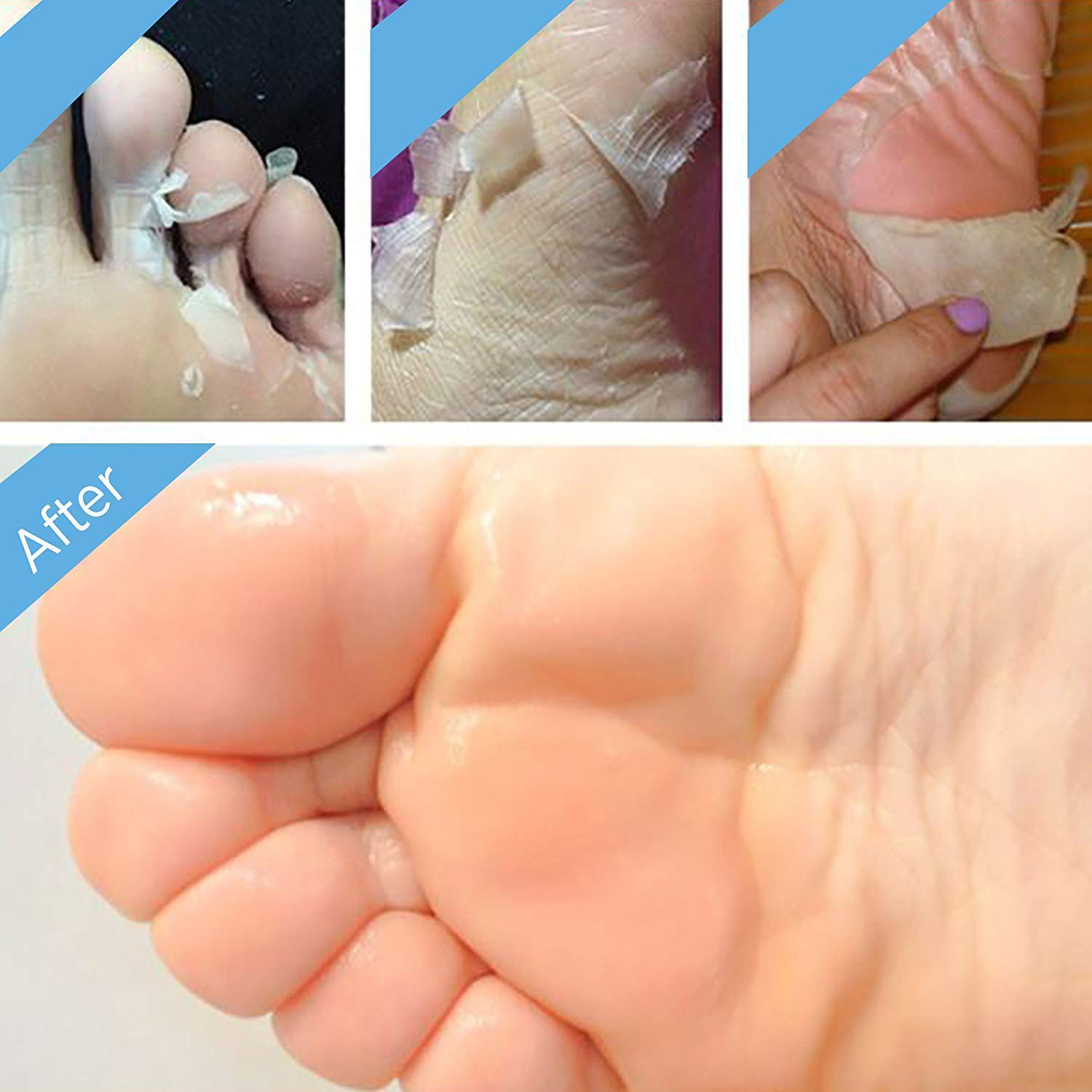 Bealuz exfoliación natural que ayuda a quitar piel muerta de los pies
