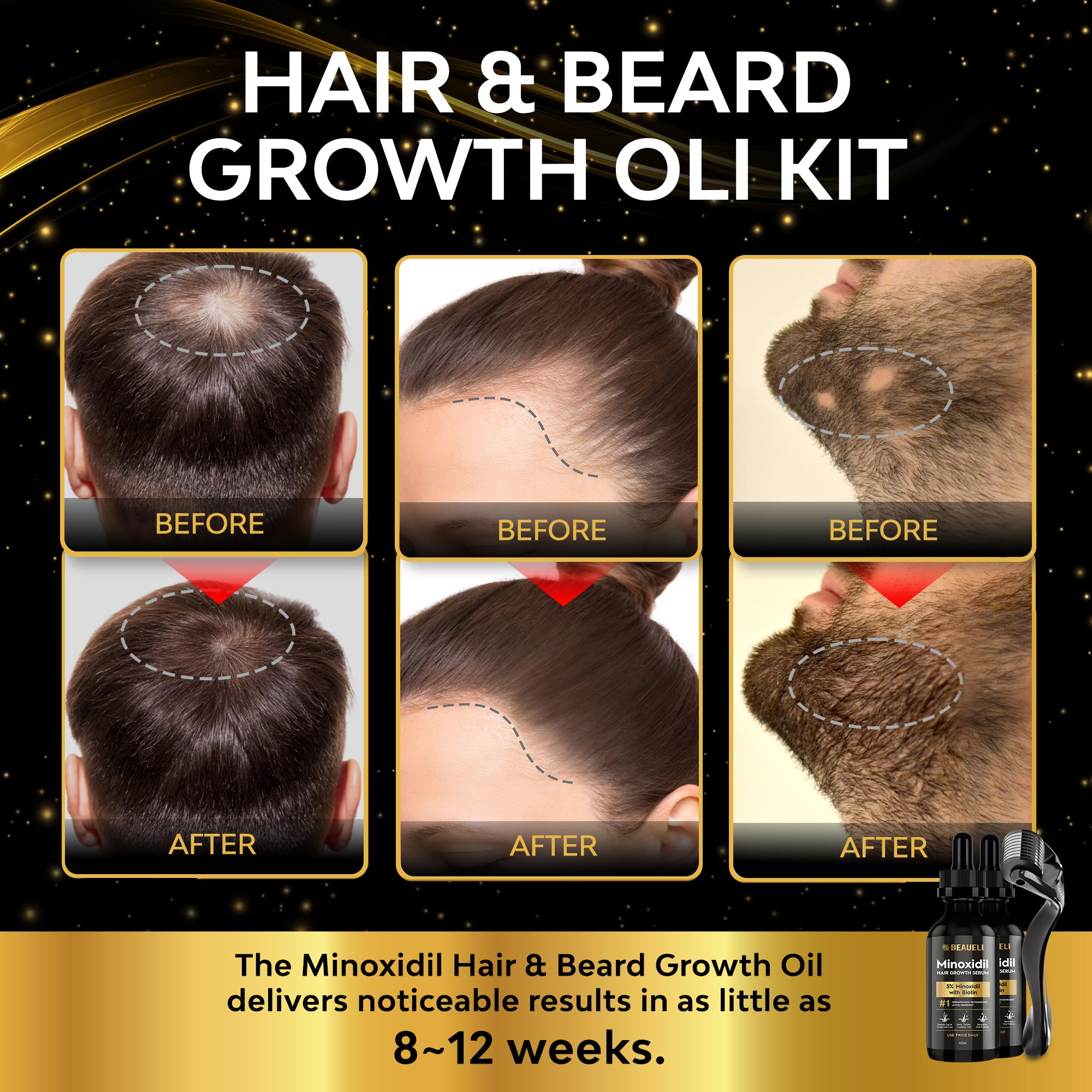 Beaueli Minoxidil 5% se aplica en la barba para un aspecto lleno.