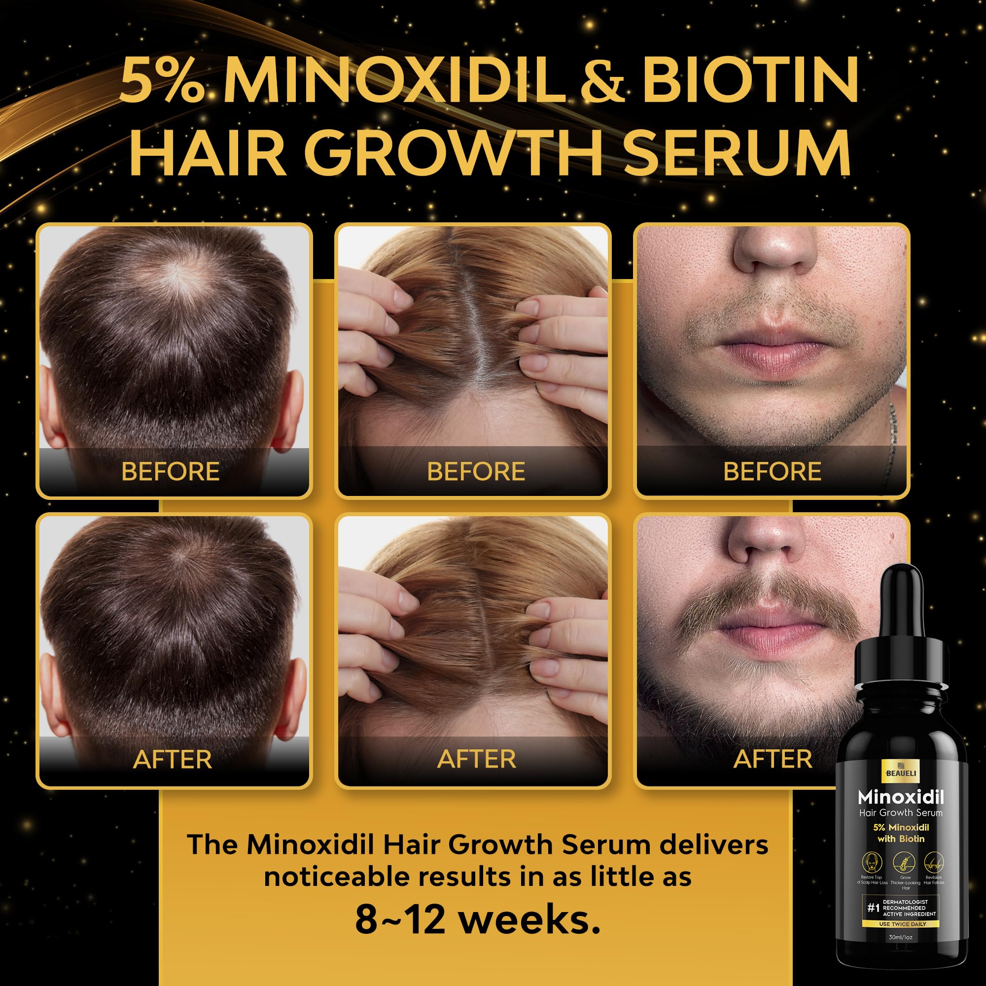 Beaueli Minoxidil empaque-caja ayuda a identificar la línea para hombres y mujeres.