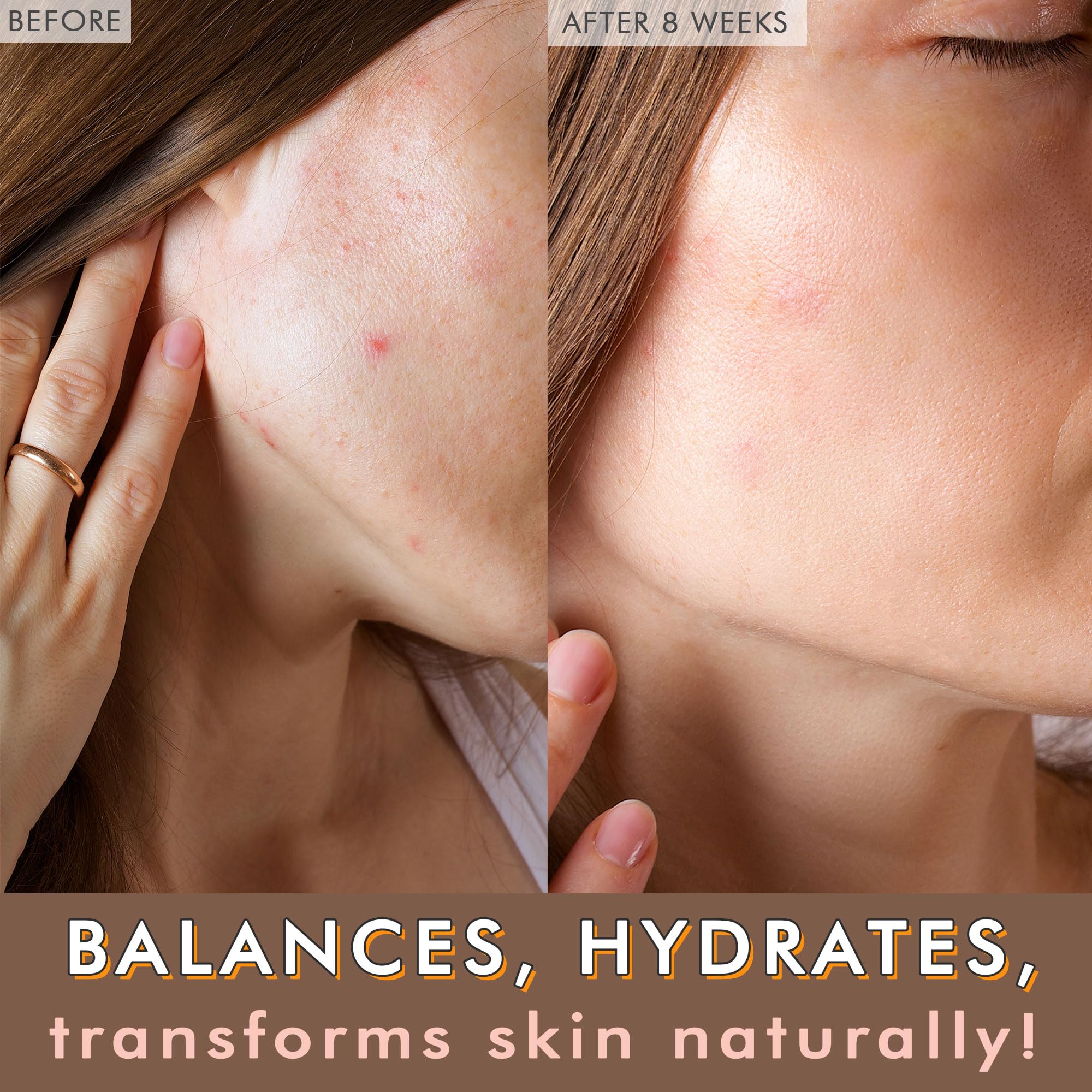 Beauty by Earth: enfoque en ingredientes clave para nutrir piel grasa propensa al acné.