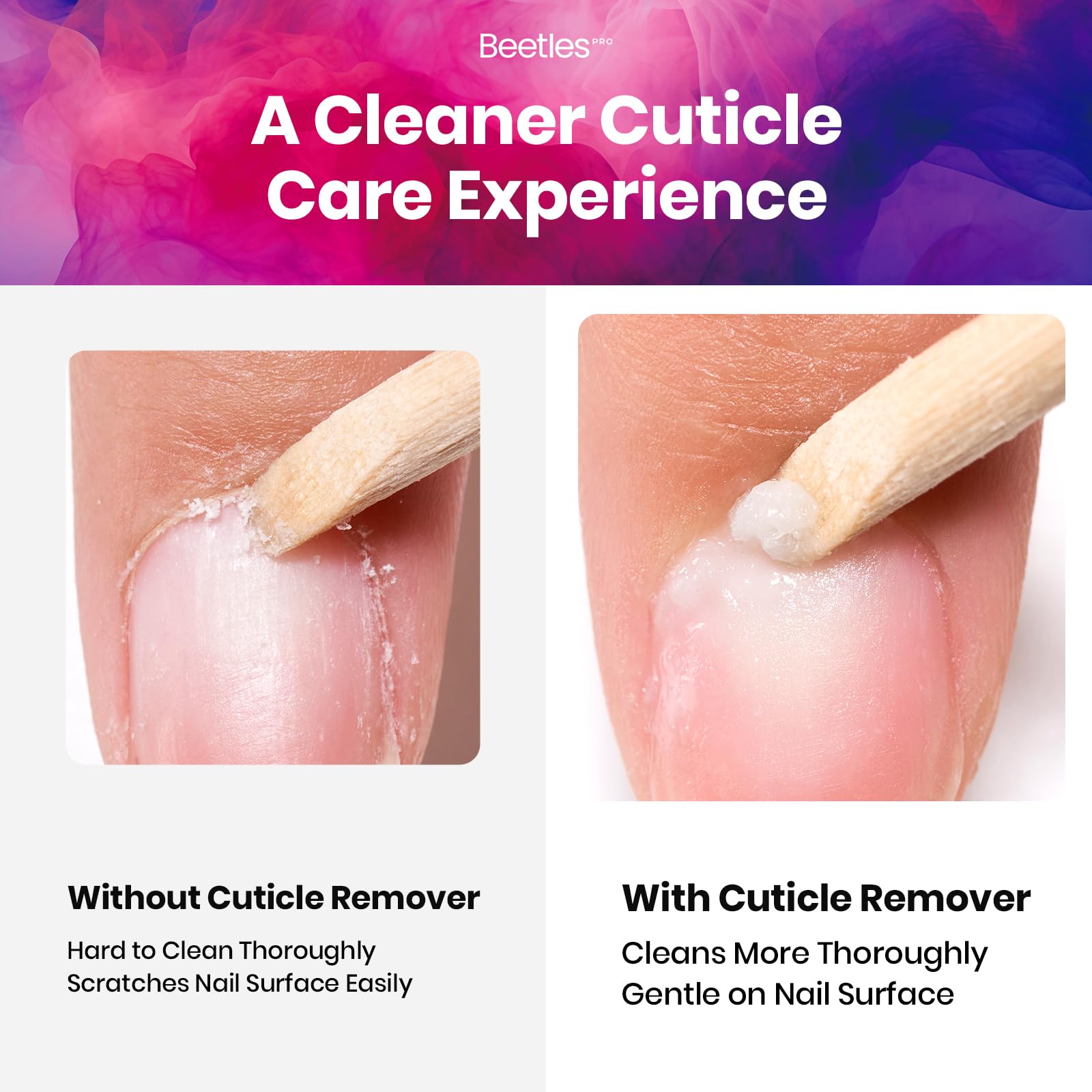 Beetles Pro Cuticle Remover, elimina piel muerta con delicadeza para uñas limpias.
