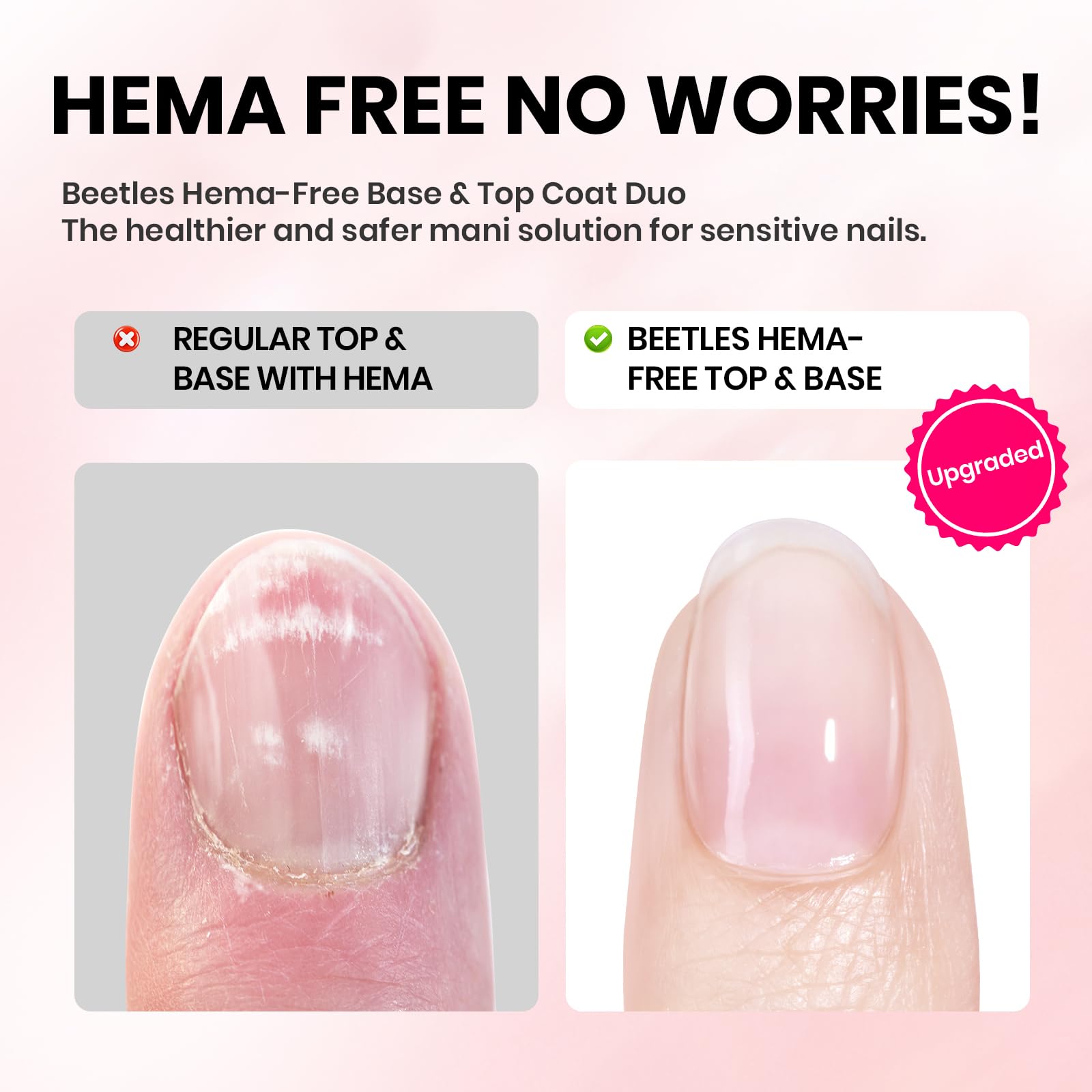 Beetles remoción fácil acetona gel 15 ml: retirada sin dañar las uñas.