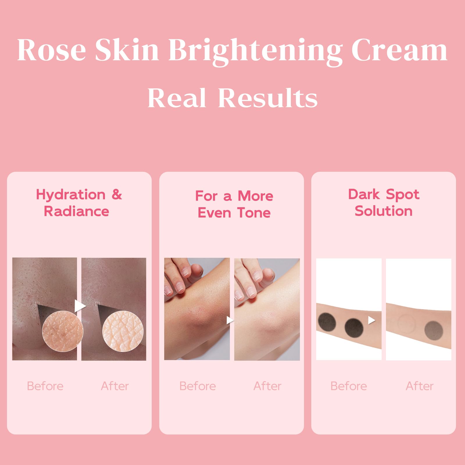 BELIARST crema para rodilla: tono equitativo y piel nutrida.