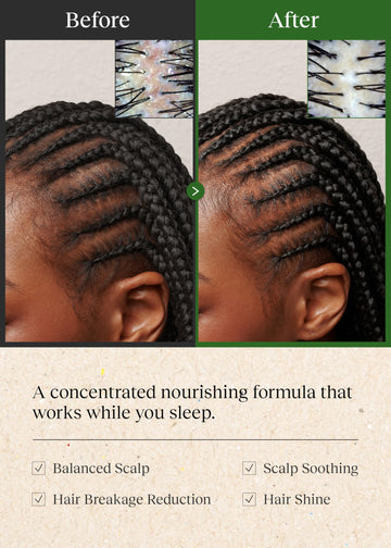 Masaje de cuero cabelludo con Bephor Braid Rev favorece la relajación