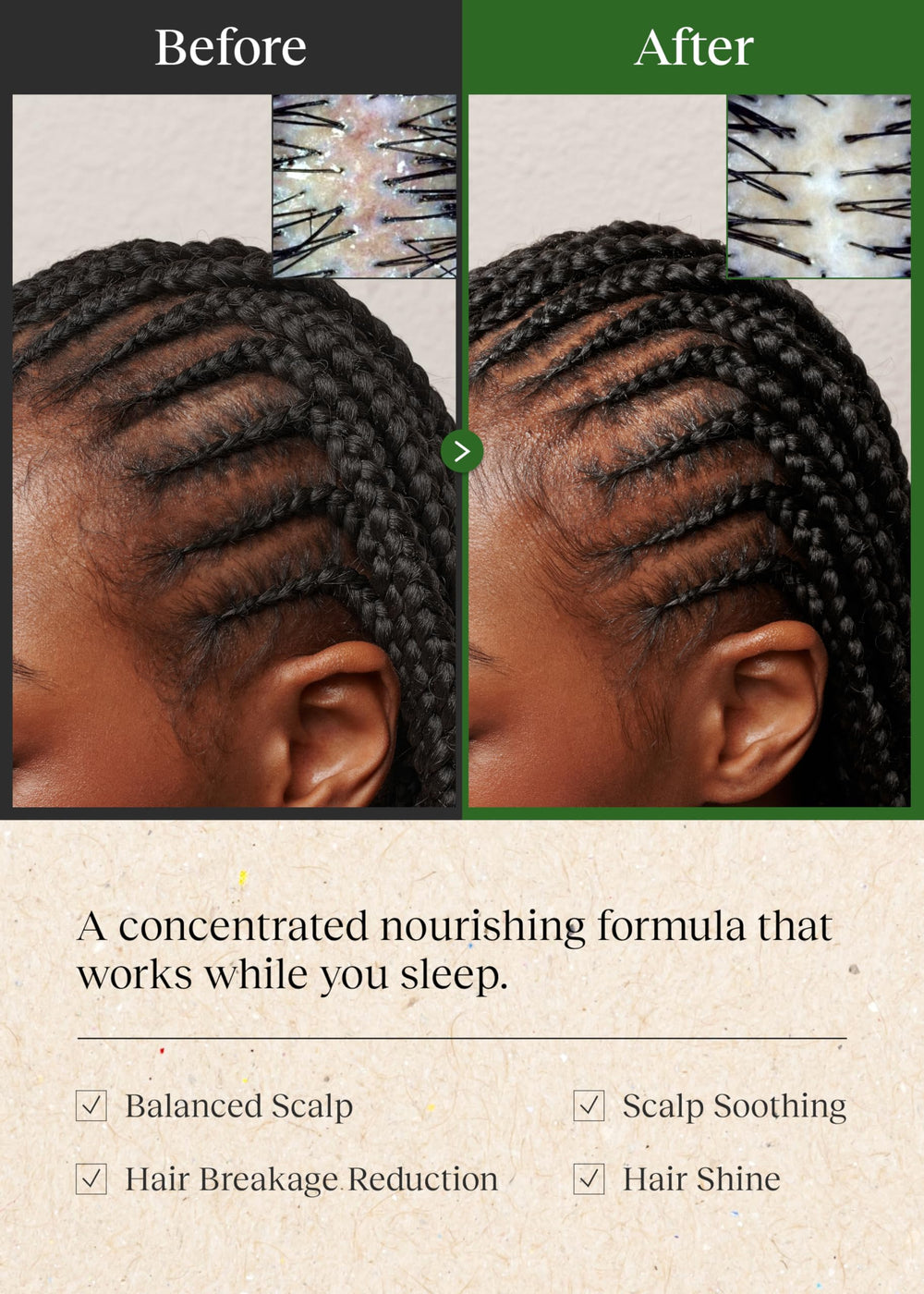 Masaje de cuero cabelludo con Bephor Braid Rev favorece la relajación
