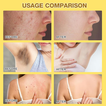 Berthg crema veneno de abeja para rodillas y espalda, confort suave.