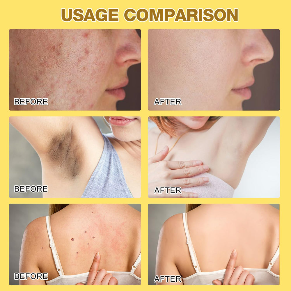Berthg crema veneno de abeja para rodillas y espalda, confort suave.