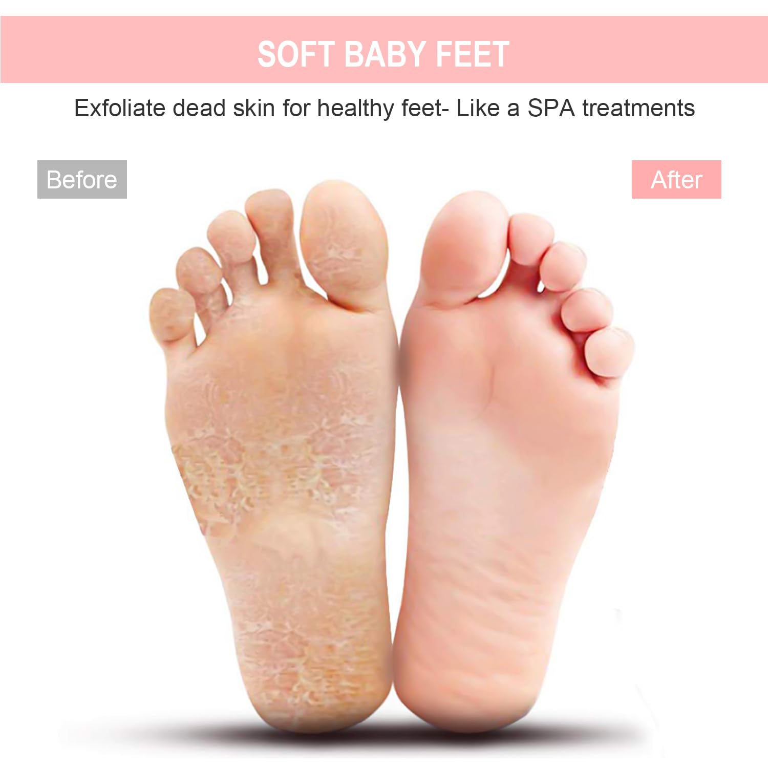 BESKAR: ventosas antideslizantes para ducha que reducen resbalones.