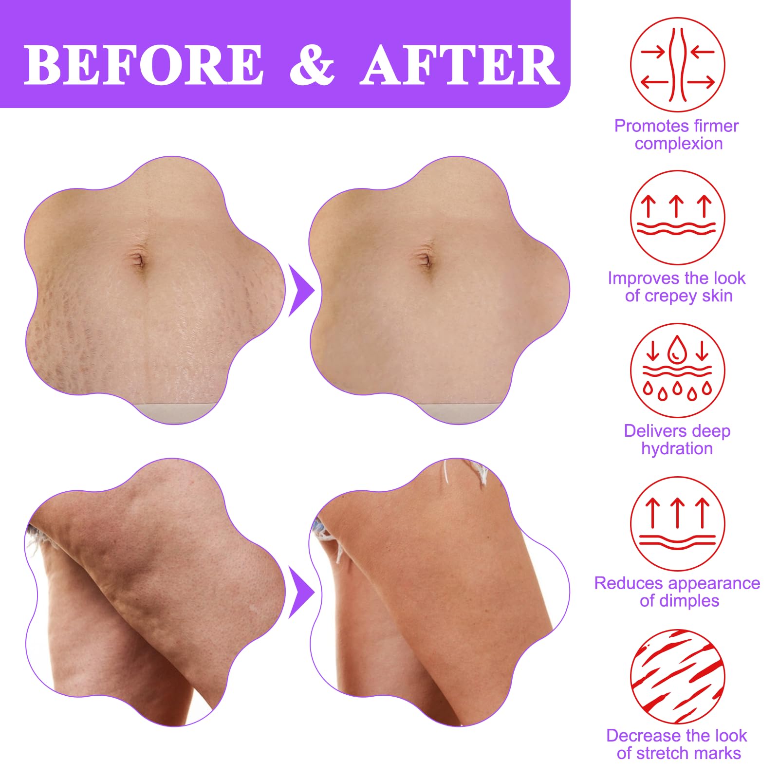 BETTENKO crema cuello tono y contorno más definido.
