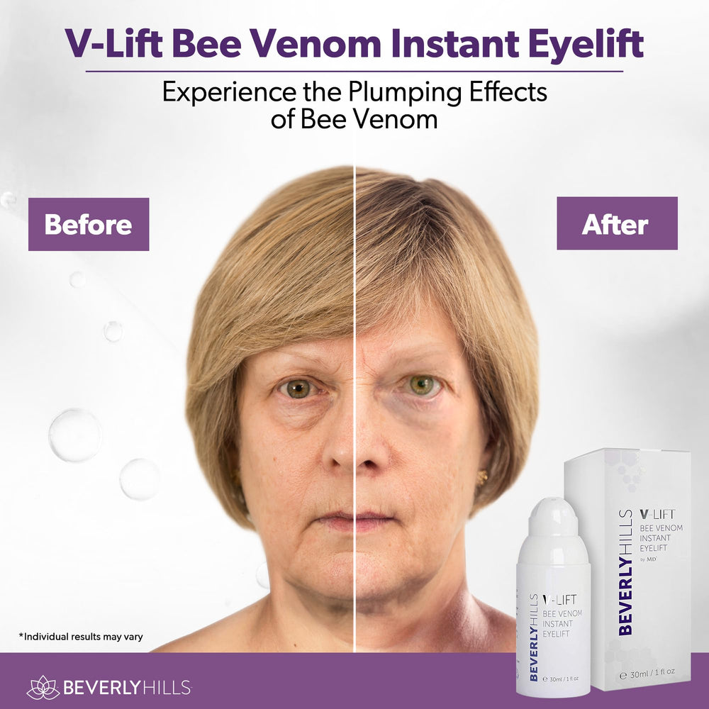 Empaque de Beverly Hills V-Lift listo para cuidado diario de ojos