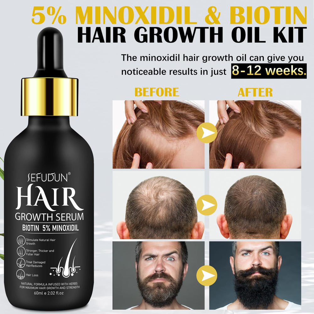 Bieyoc Minoxidil Sérum: aplicación con dedos para absorción rápida en el cuero cabelludo.