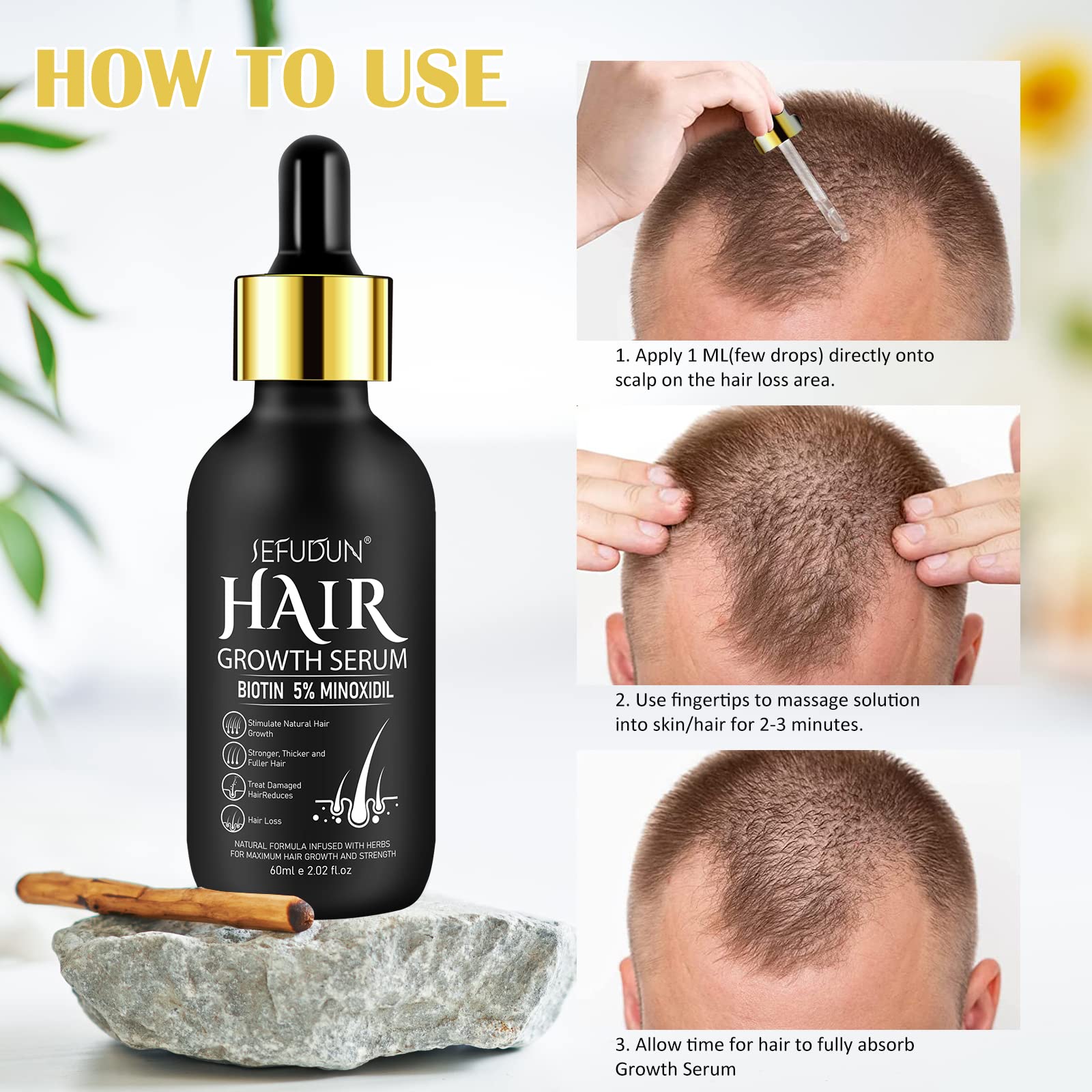 Bieyoc Minoxidil Sérum: aporta brillo y vitalidad al cabello.