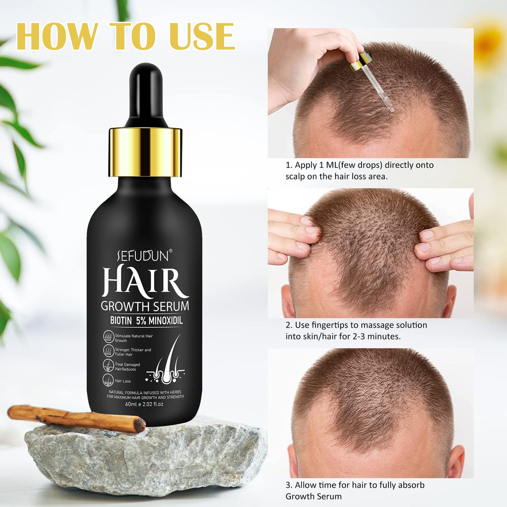 Bieyoc Minoxidil Sérum: aporta brillo y vitalidad al cabello.