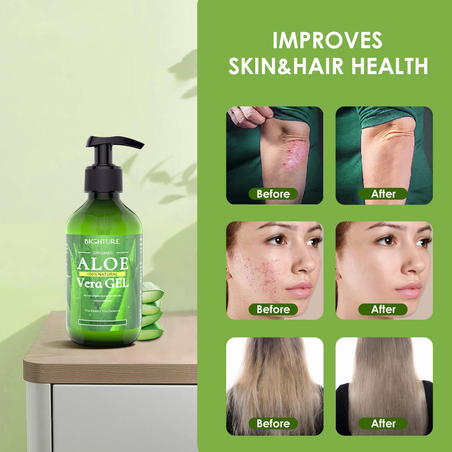 Gel de Aloe Vera BIGHTURE para irritación por afeitado, enfriamiento y confort.
