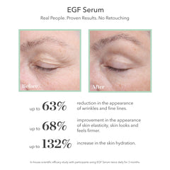 Bioeffect EGF Serum: aplicacion rostro con hidratacion.