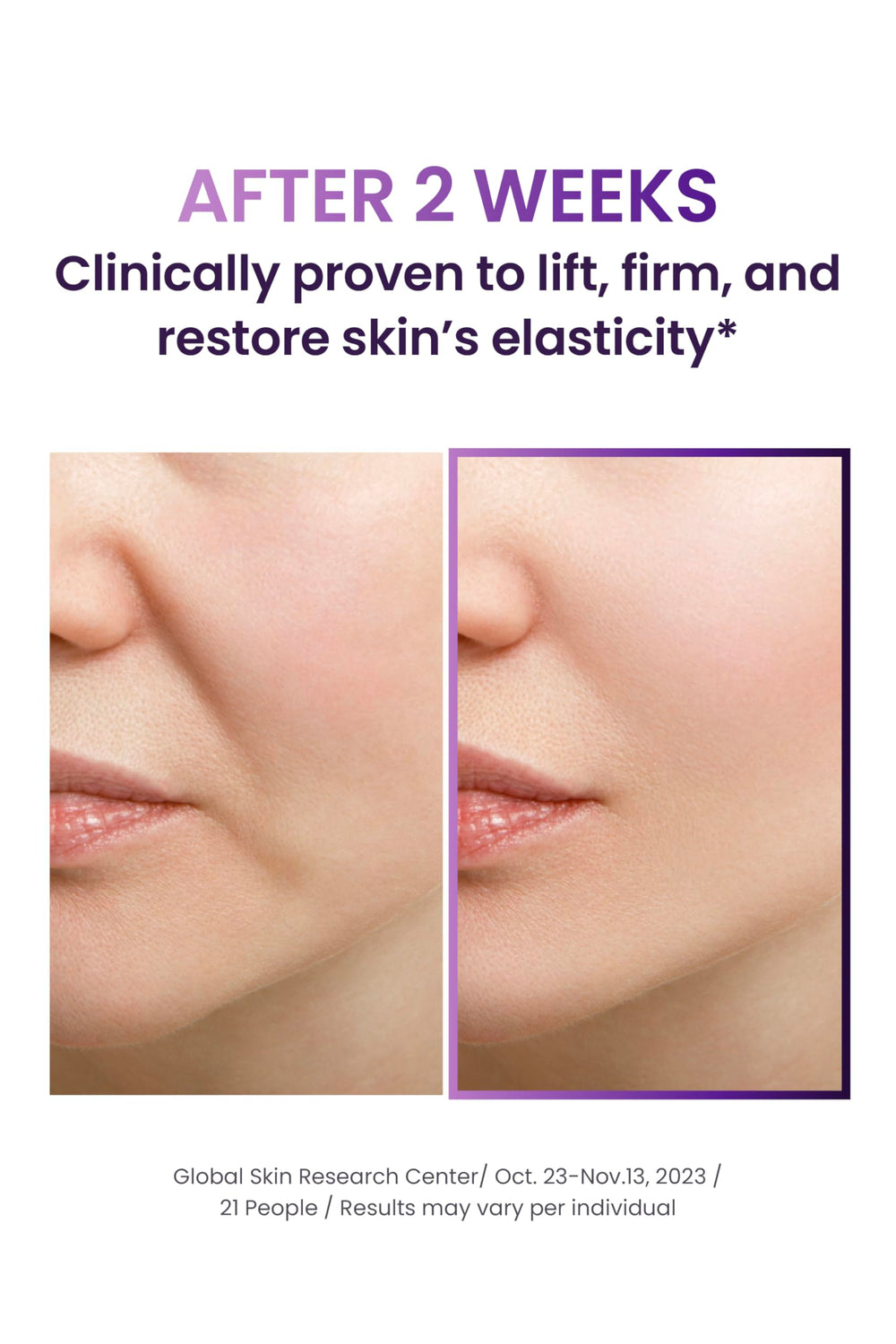 Aplicación suave de BIOHEAL BOH Probioderm 3D Lifting para rutina fácil.