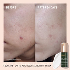 Biossance Rapid Radiance Tónico Iluminador, mejora la uniformidad del tono.