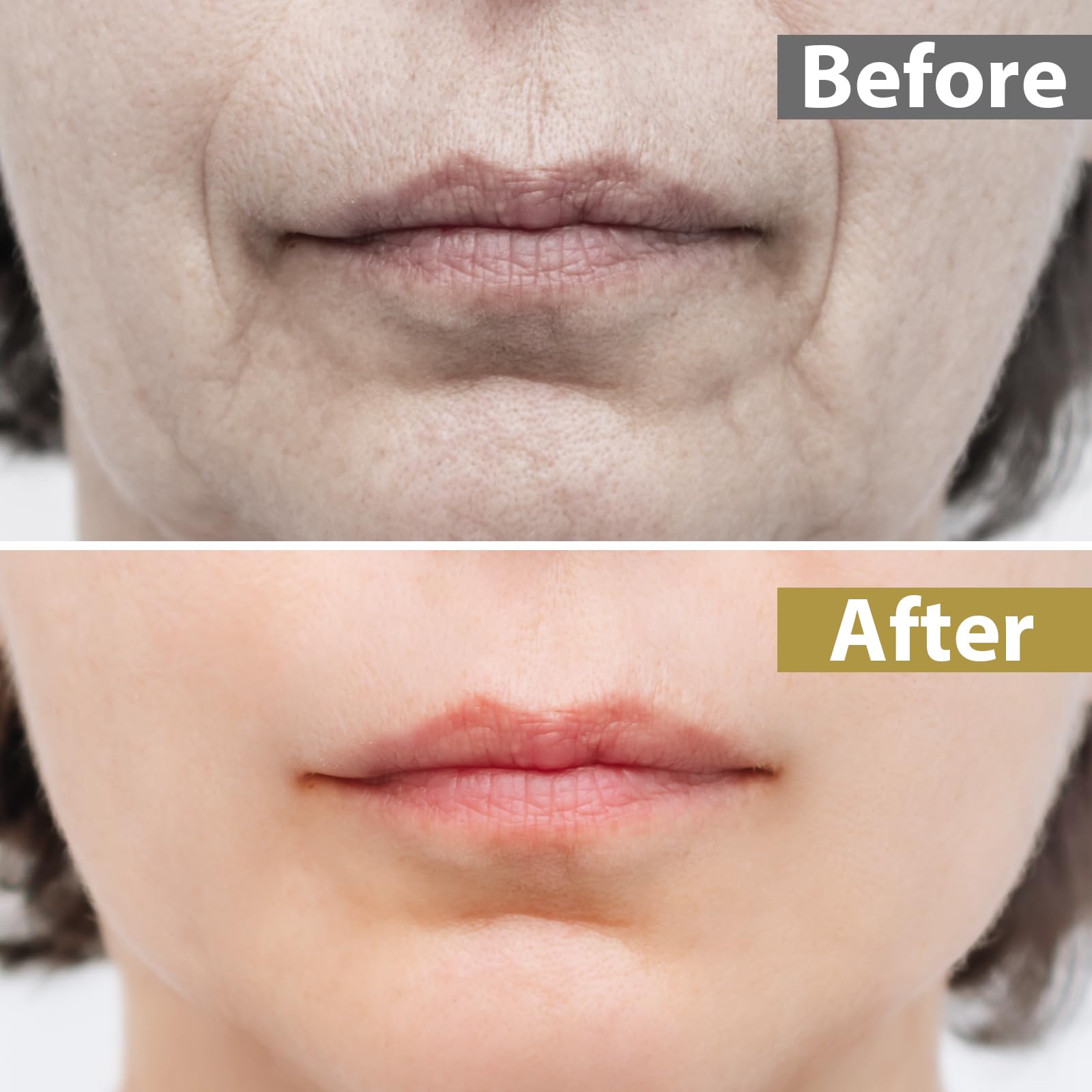 Parche labial Bizzico transparente ultrafino que se nota poco.