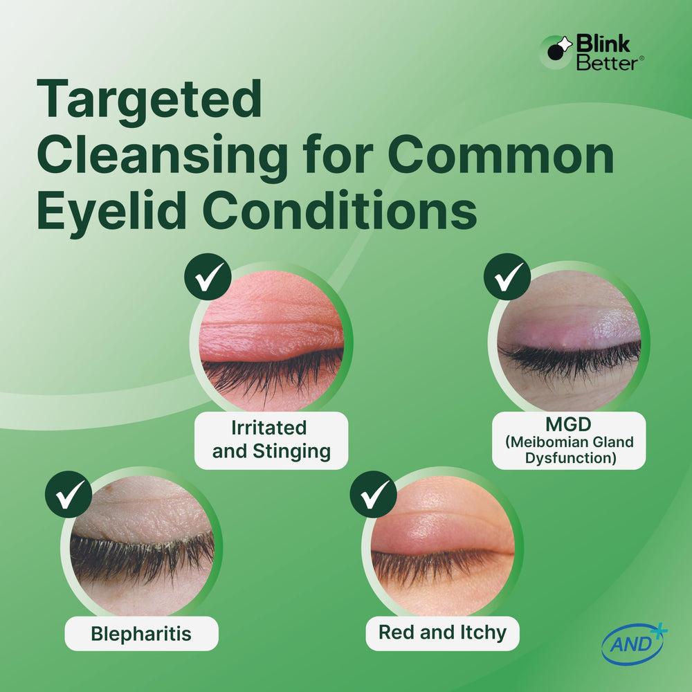 Aplicación suave de BetterLids Gel en la rutina de párpados, fácil y rápida.