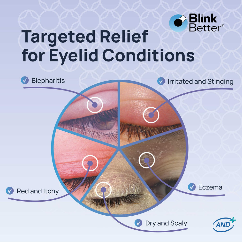 BlinkBetter BetterLids pantenol ofrece nutrición suave y soporte a la barrera cutánea.