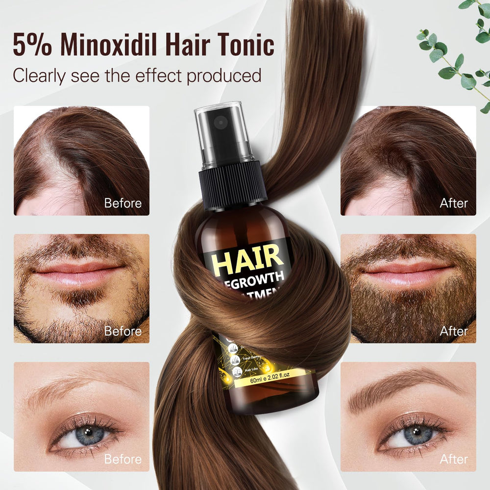 BLISSMATE Minoxidil, aplicación en cuero cabelludo para comodidad diaria