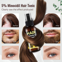 BLISSMATE Minoxidil, aplicación en cuero cabelludo para comodidad diaria