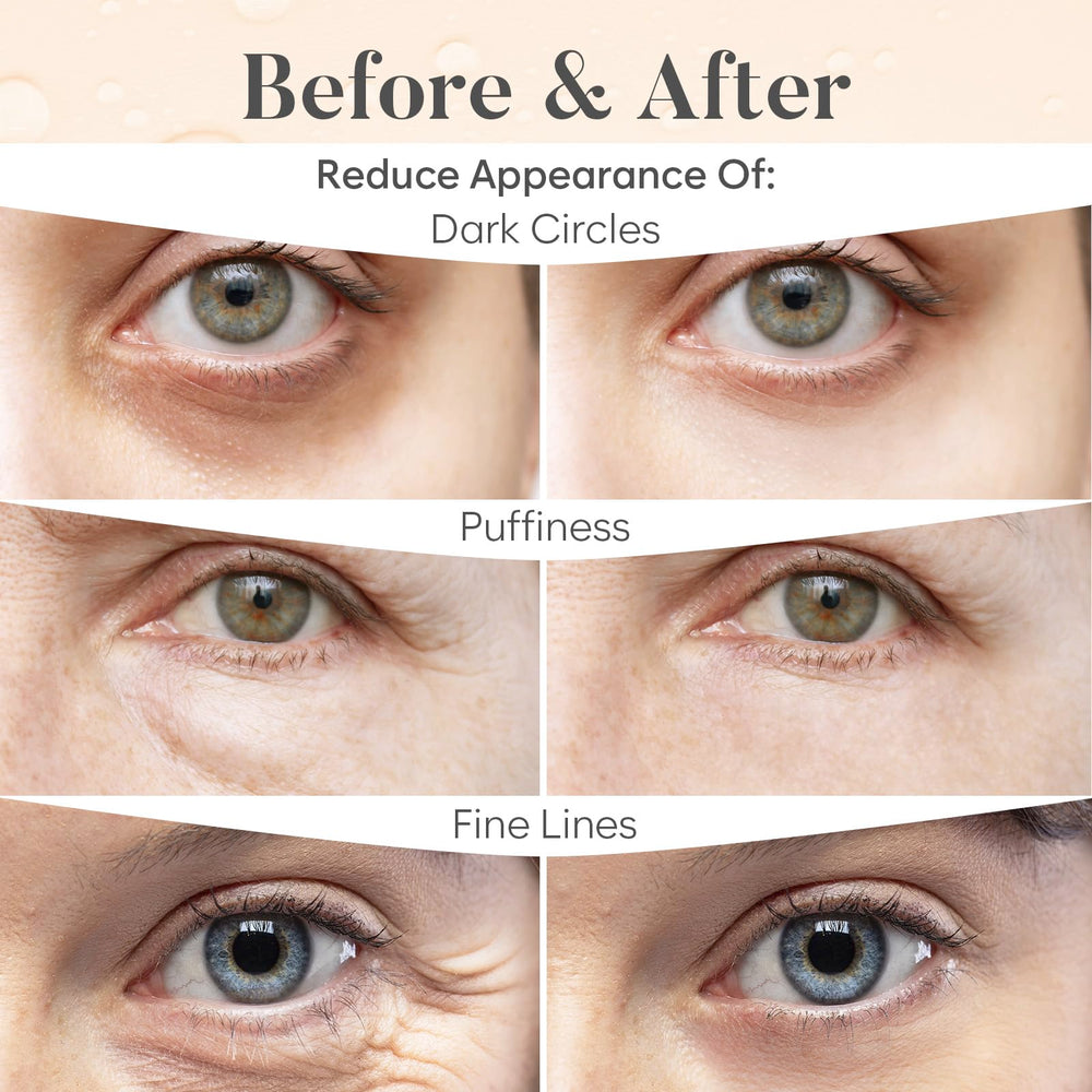 BLOOMORA parches ojos niacinamida: mejora elasticidad suave