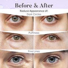 Parches BLOOMORA suaves para piel sensible alrededor de ojos