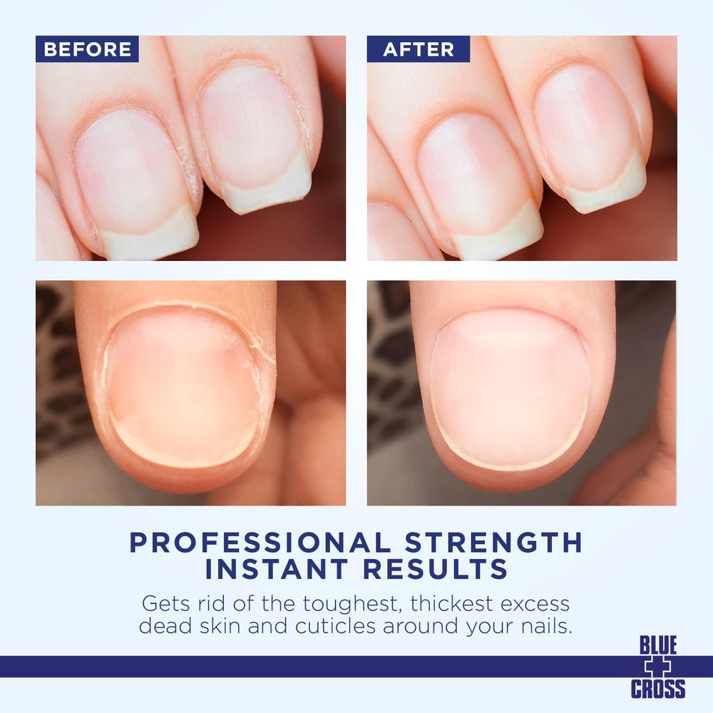 Blue Cross aplicador de precisión facilita la aplicación en la base de las uñas.