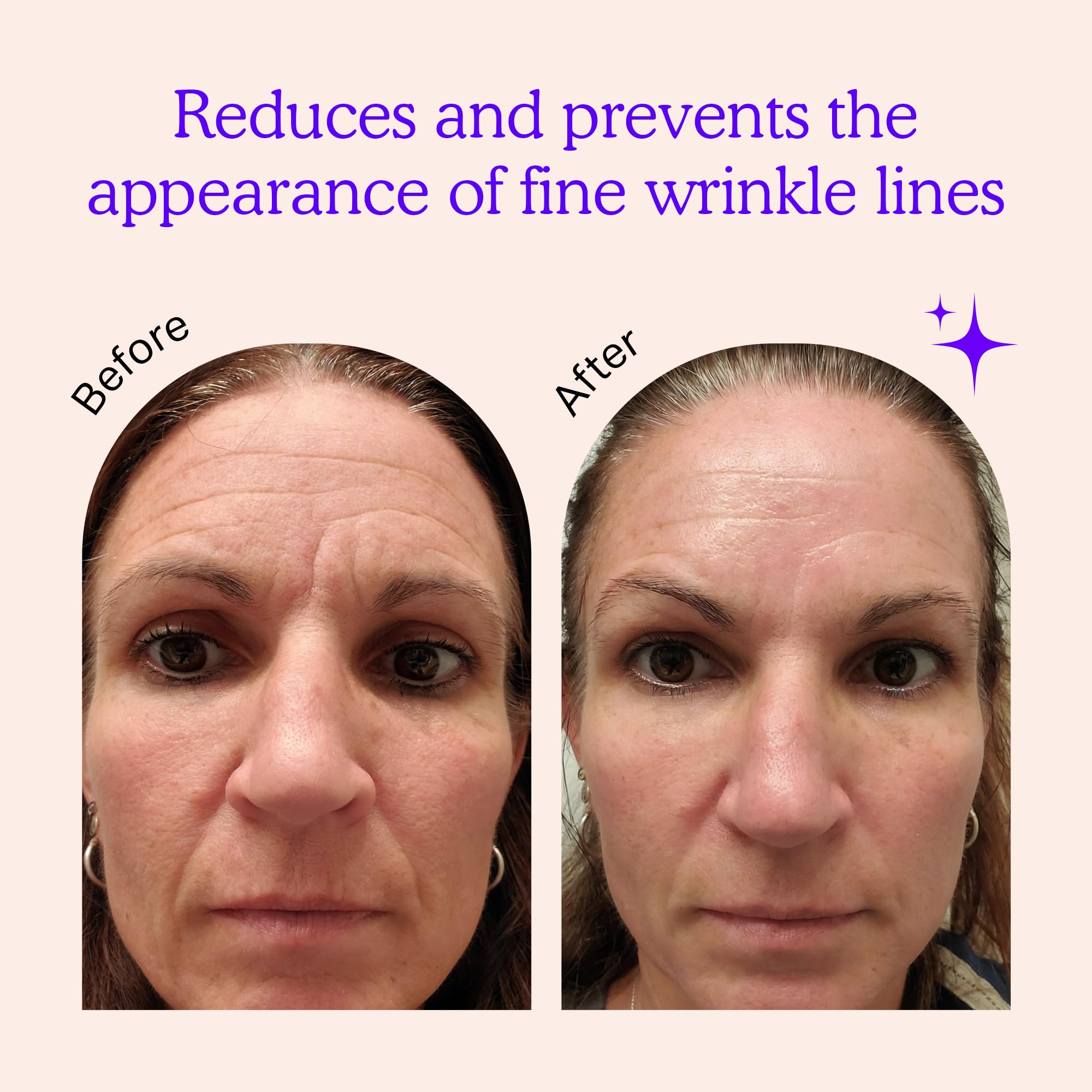 BLUMBODY forehead wrinkle patches reduce the appearance of furrows while you rest.