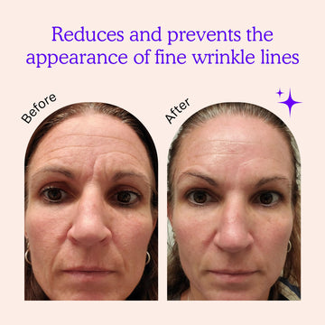BLUMBODY forehead wrinkle patches reduce the appearance of furrows while you rest.