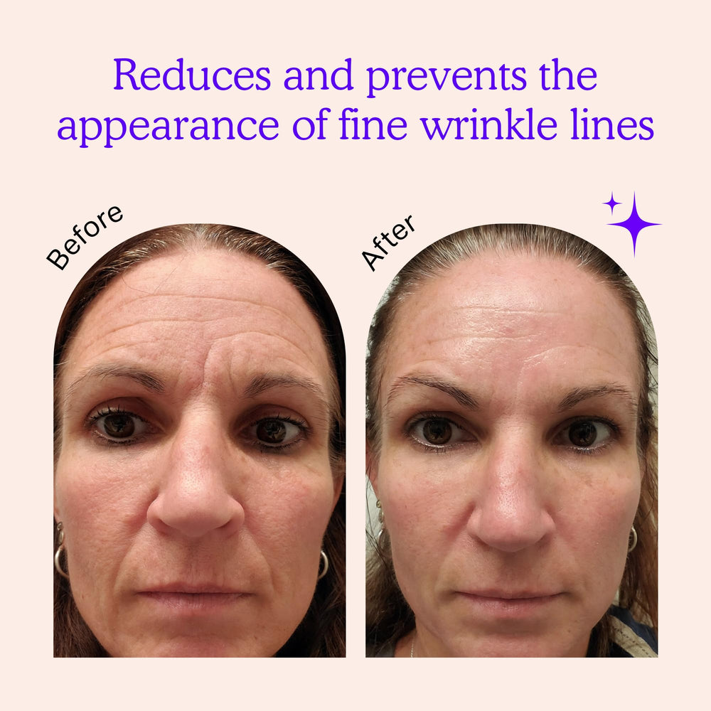 BLUMBODY forehead wrinkle patches reduce the appearance of furrows while you rest.