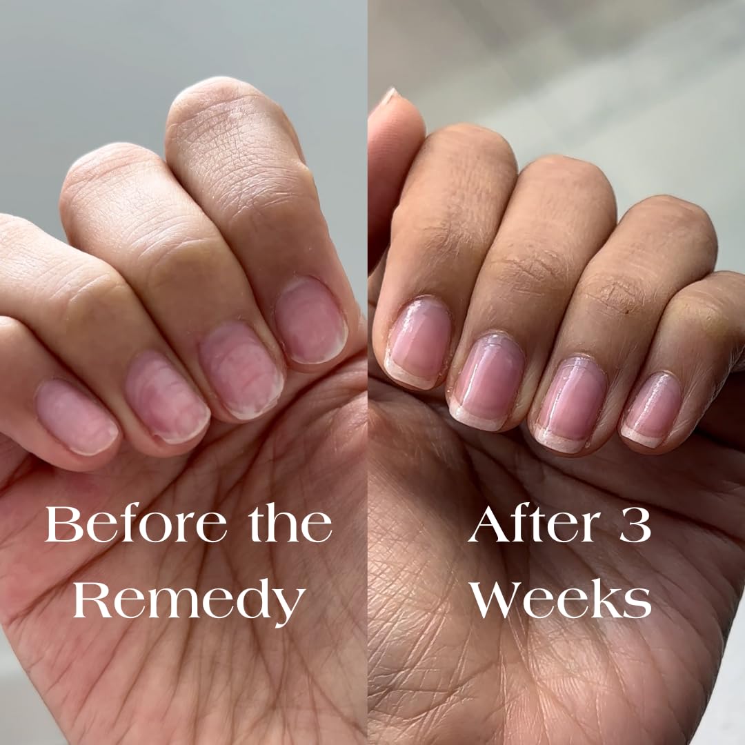 Botanist Nails El Remedio, uñas dañadas restauradas visualmente con brillo rosado.