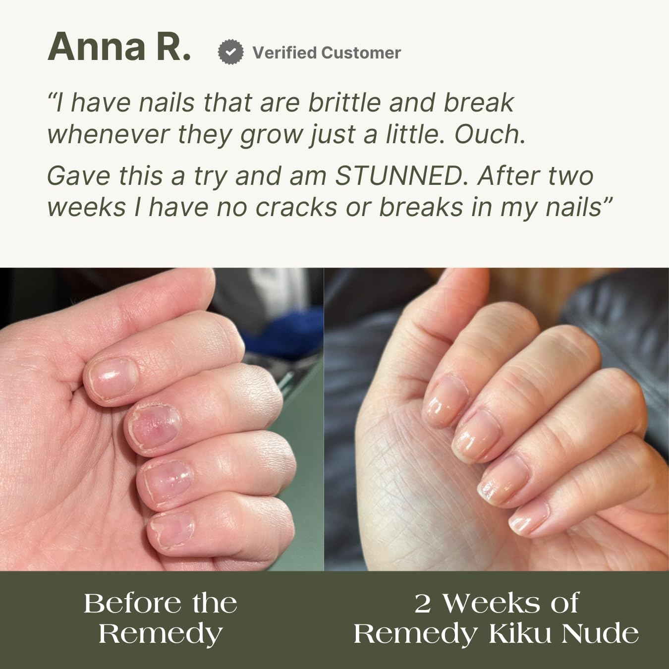 Botanist Nails Remedy: ingredientes basados en plantas como aceites y aminoácidos.