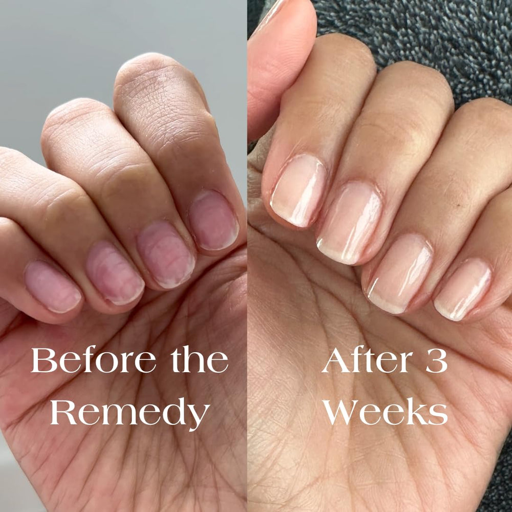 Botanist Nails Remedy: uñas con acabado brillante y protegido.