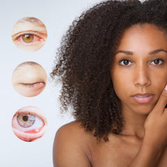 Key ingredients hyaluronic acid calendula arnica in BrazzoMD Stye Relief cleanser