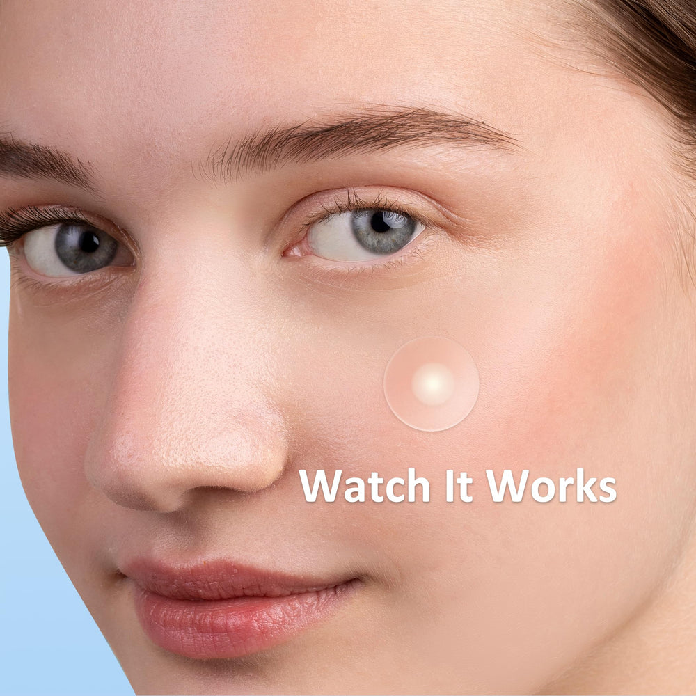 Ensemble de patches Breiboz en formes variées pour couverture complète.