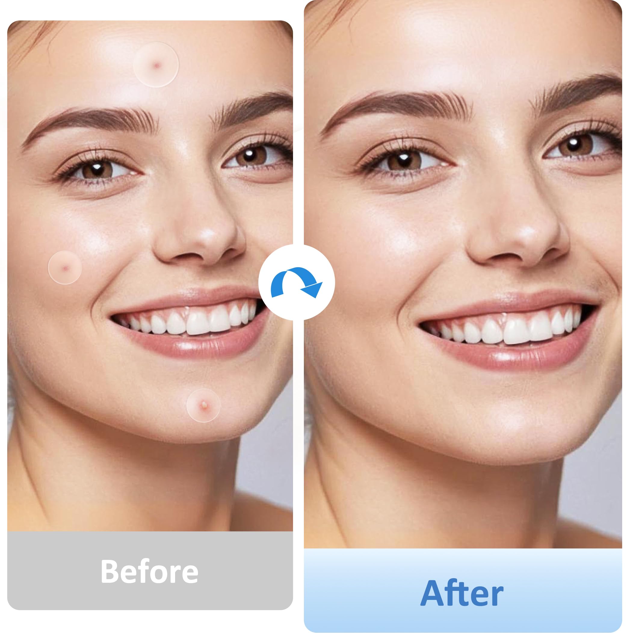 Patch Breiboz grand format couvre les gros boutons et apaise.