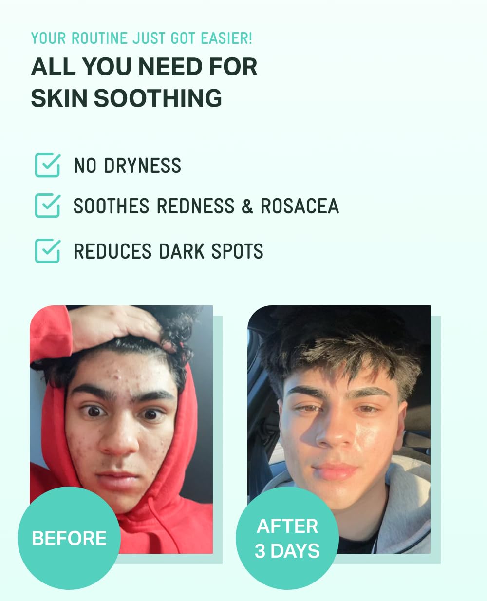 BRING GREEN Zinc TECA Serum, ayuda a minimizar poros para tono uniforme.