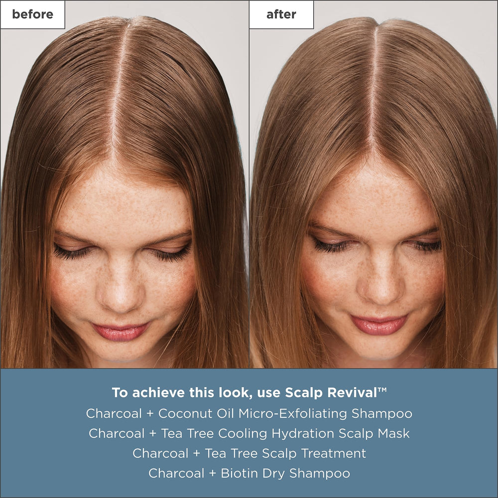 Briogeo Scalp Revival hidrata con ácido hialurónico para balancear.