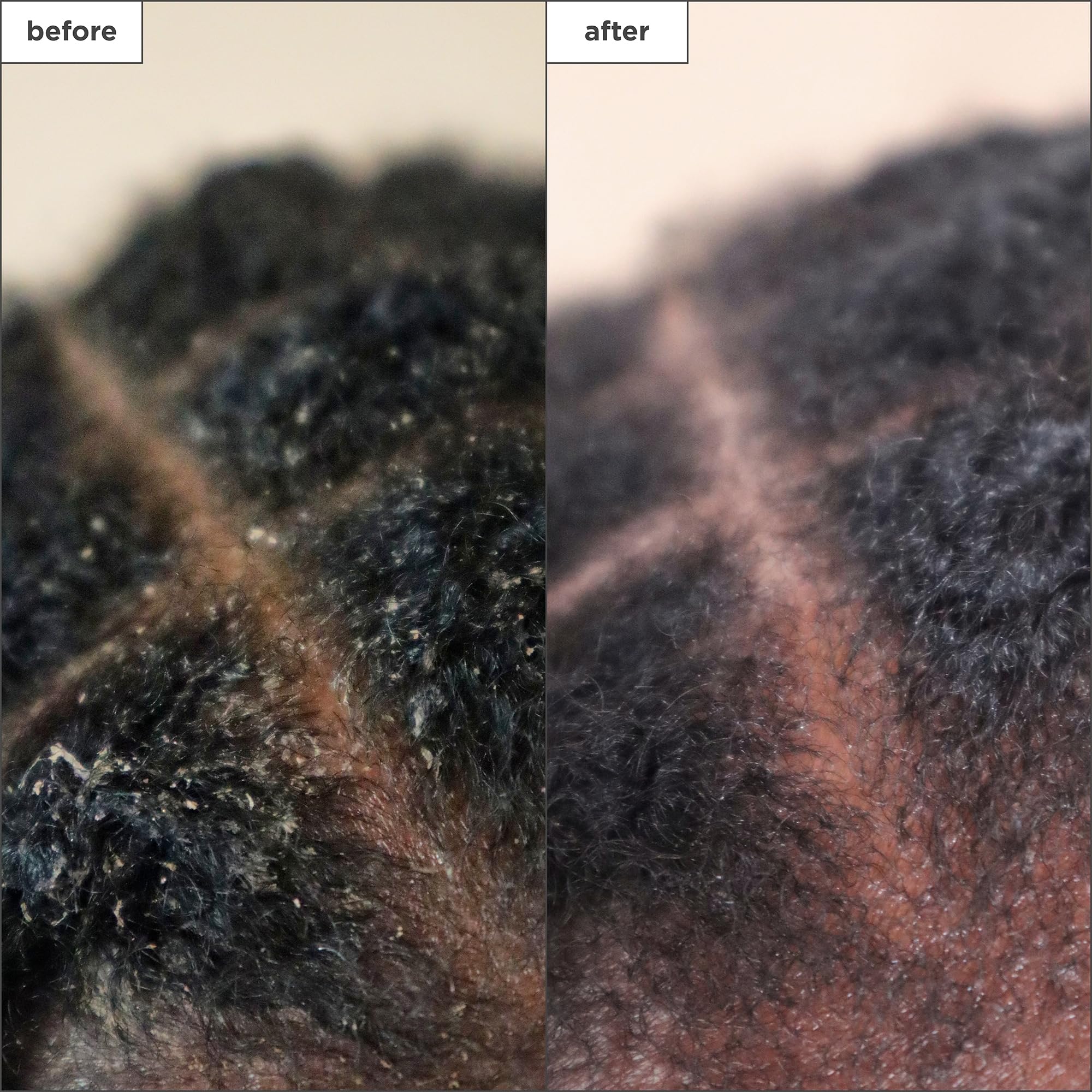 Briogeo Scalp Revival con hamamelis, alivio suave al aplicar.