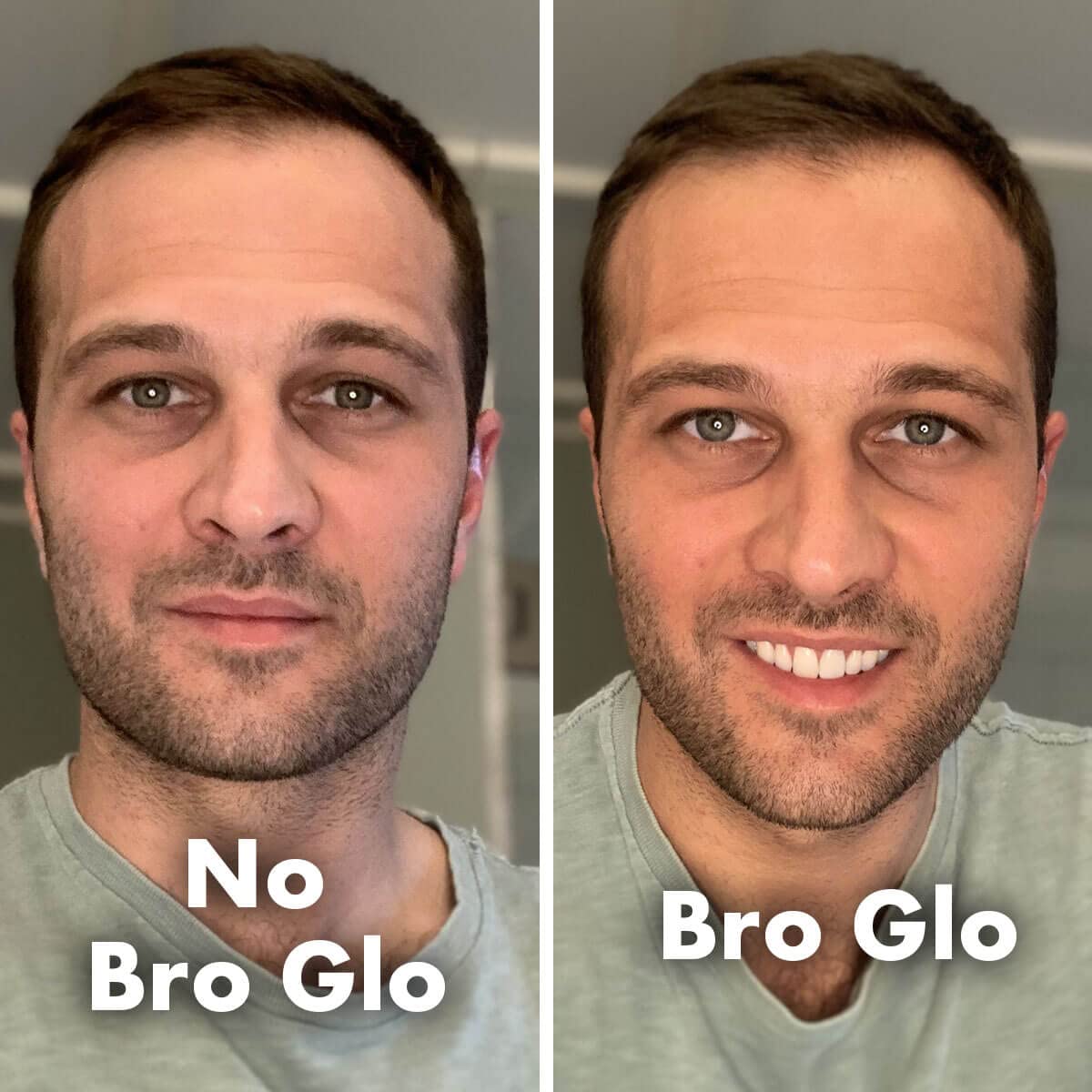 Bro Glo set regalo de inicio, adecuado para comenzar a usarlo sin complicaciones.
