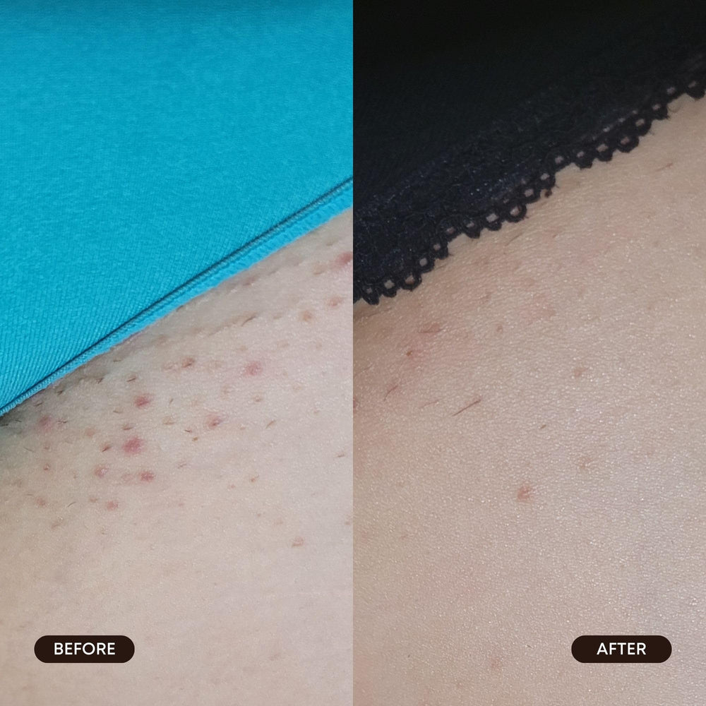 Bushbalm aplicación diaria en axilas y bikini para piel suave.