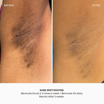 Rutina de dos pasos Bermuda para piel pulida y menos irritación.